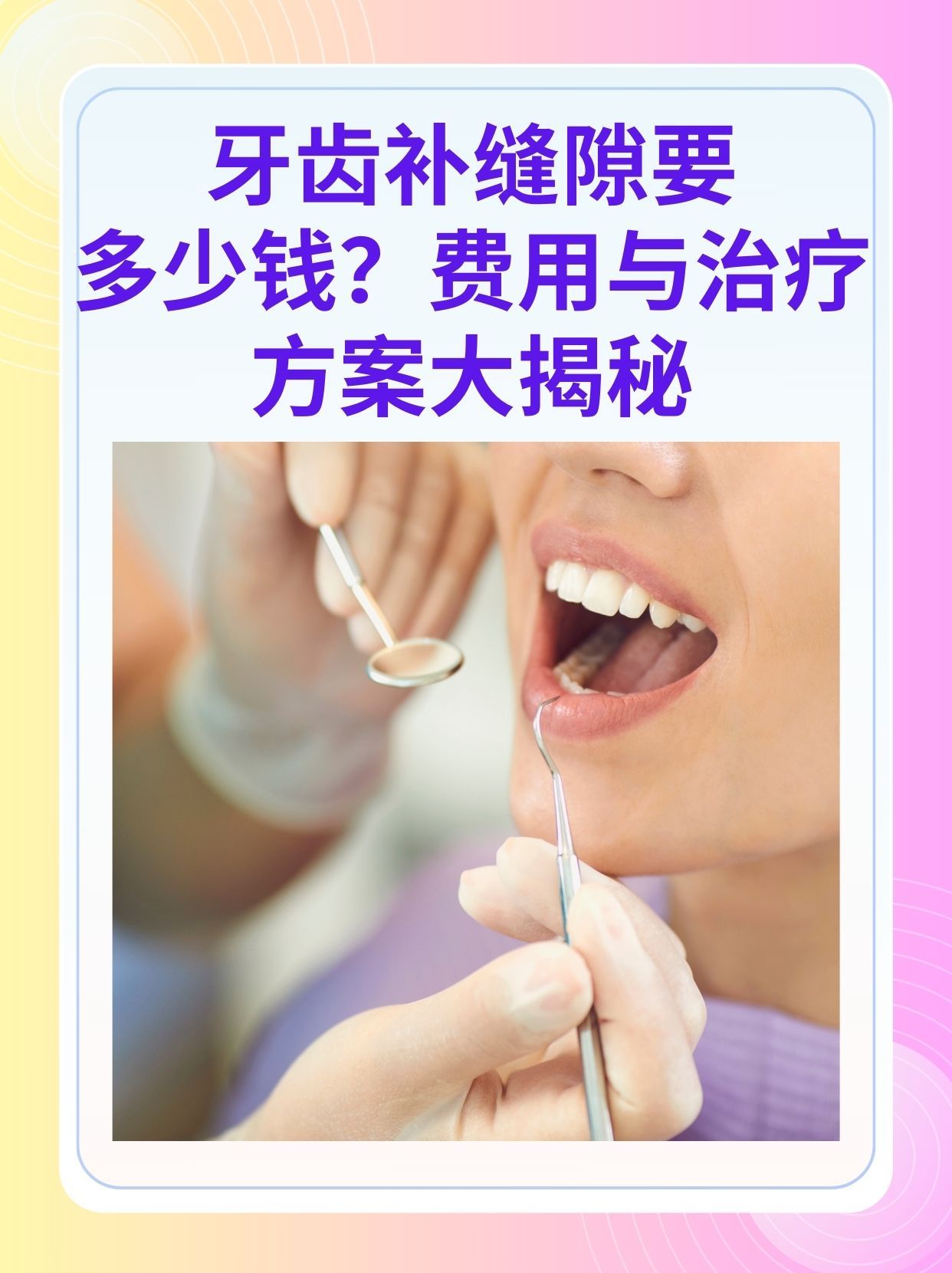 江西补牙医保可以报销吗(补牙医保可以报销吗 哪些可以报销呢)